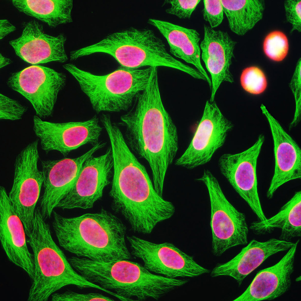 ICC/IF-image-mouse-anti-beta Tubulin-monoclonal-antibody-4E4-1222