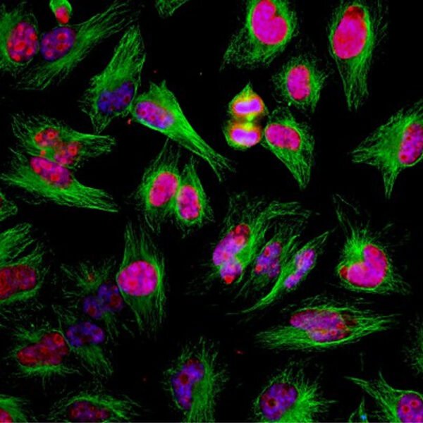 ICC/IF image chicken anti Ki67 polyclonal antibody 1247