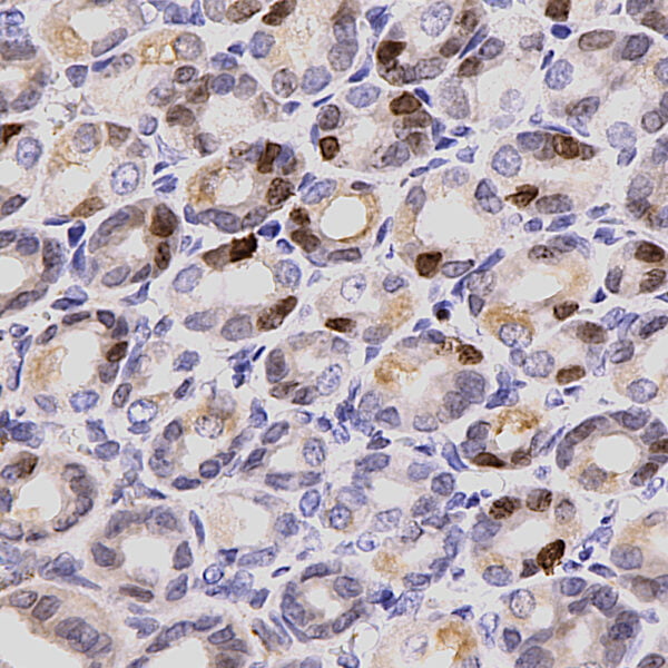 IHC image chicken anti Ki67 polyclonal antibody 1247