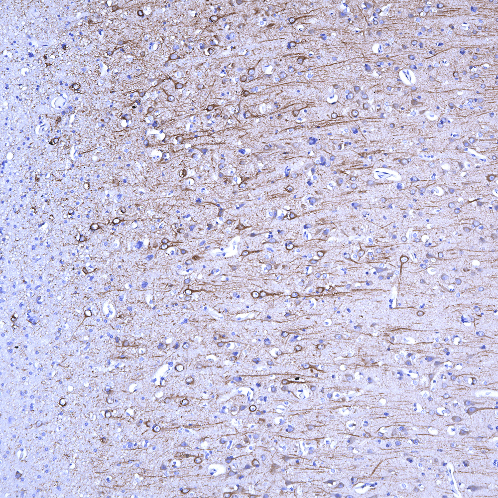 IHC-image-mouse-anti-MAP2-monoclonal-antibody-5H11-1367