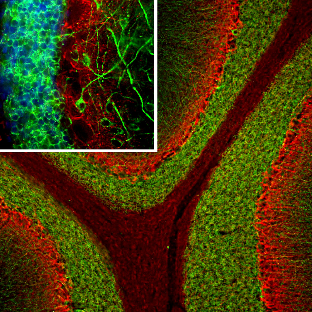 ICC/IF-image-mouse-anti-MAP2-monoclonal-antibody-5H11-1367