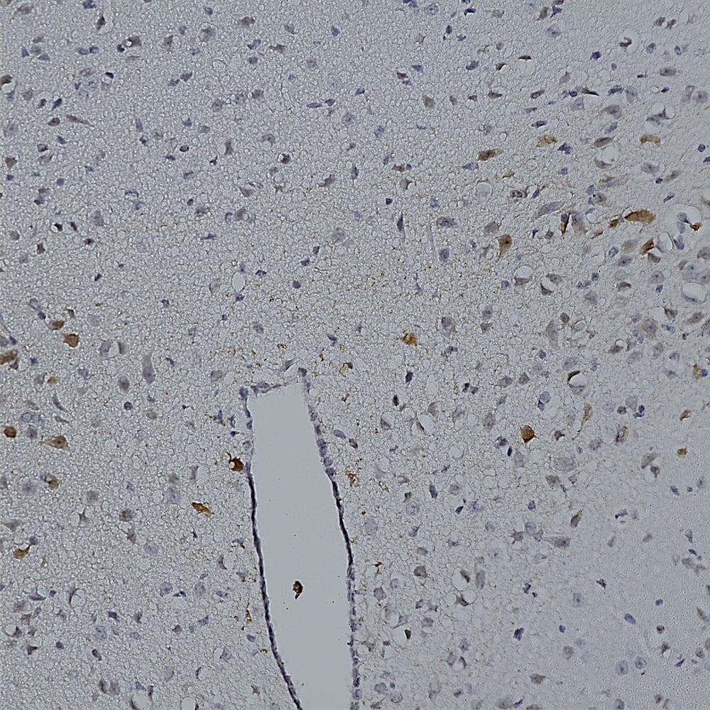 IHC-image-chicken-anti-mCherry-polyclonal-antibody-1514
