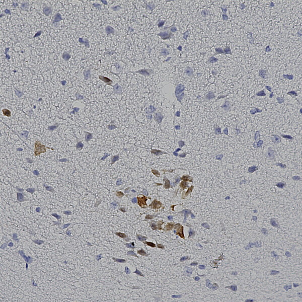 IHC image goat anti mCherry polyclonal antibody 1536