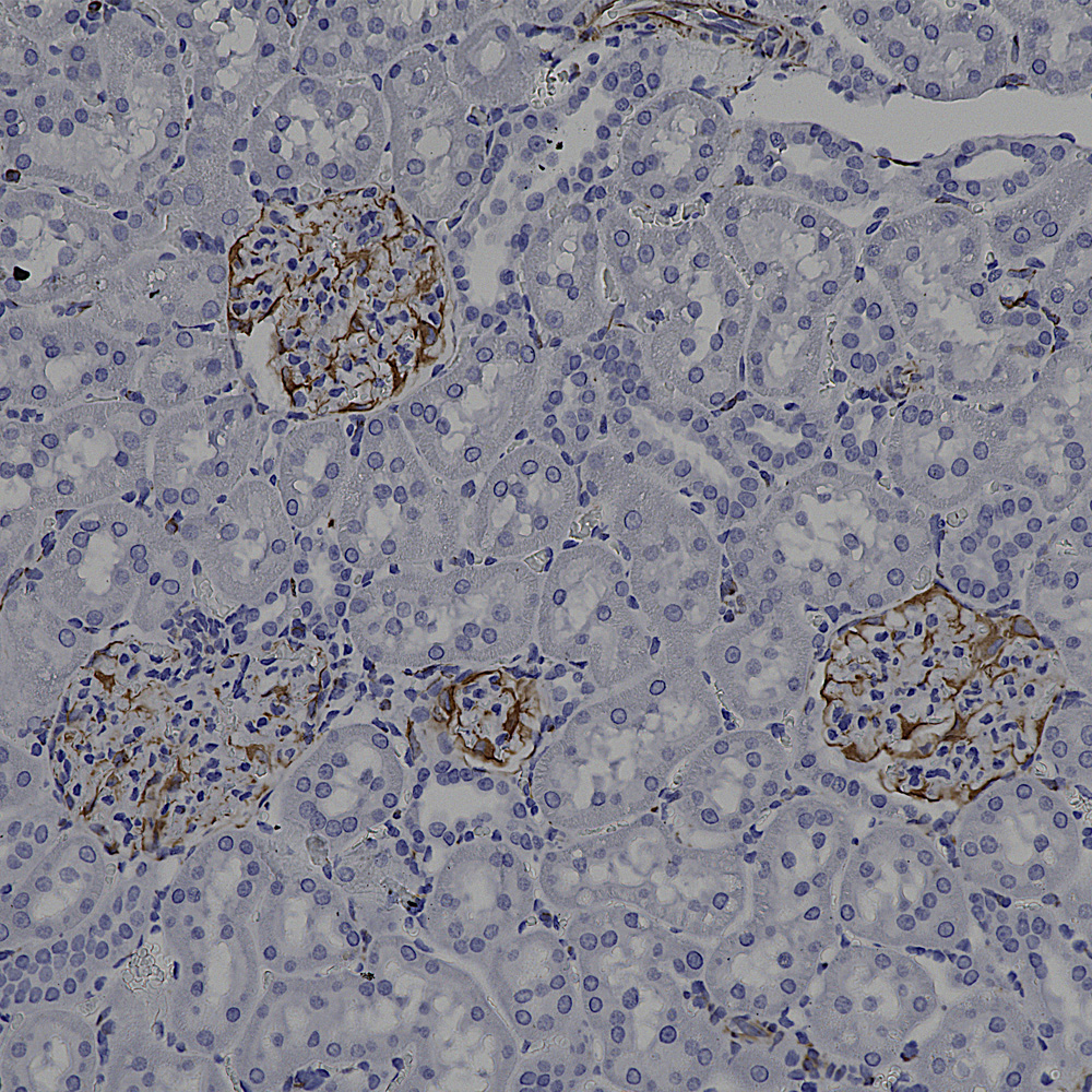 IHC-image-mouse-anti-Vimentin-monoclonal-antibody-2D1-1666