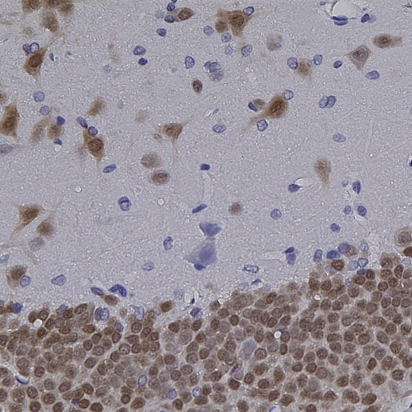 IHC image mouse anti NeuN monoclonal antibody 1B7 2083