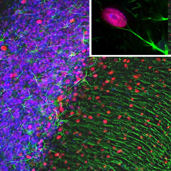 ICC/IF image rabbit anti GFAP polyclonal antibody 2539