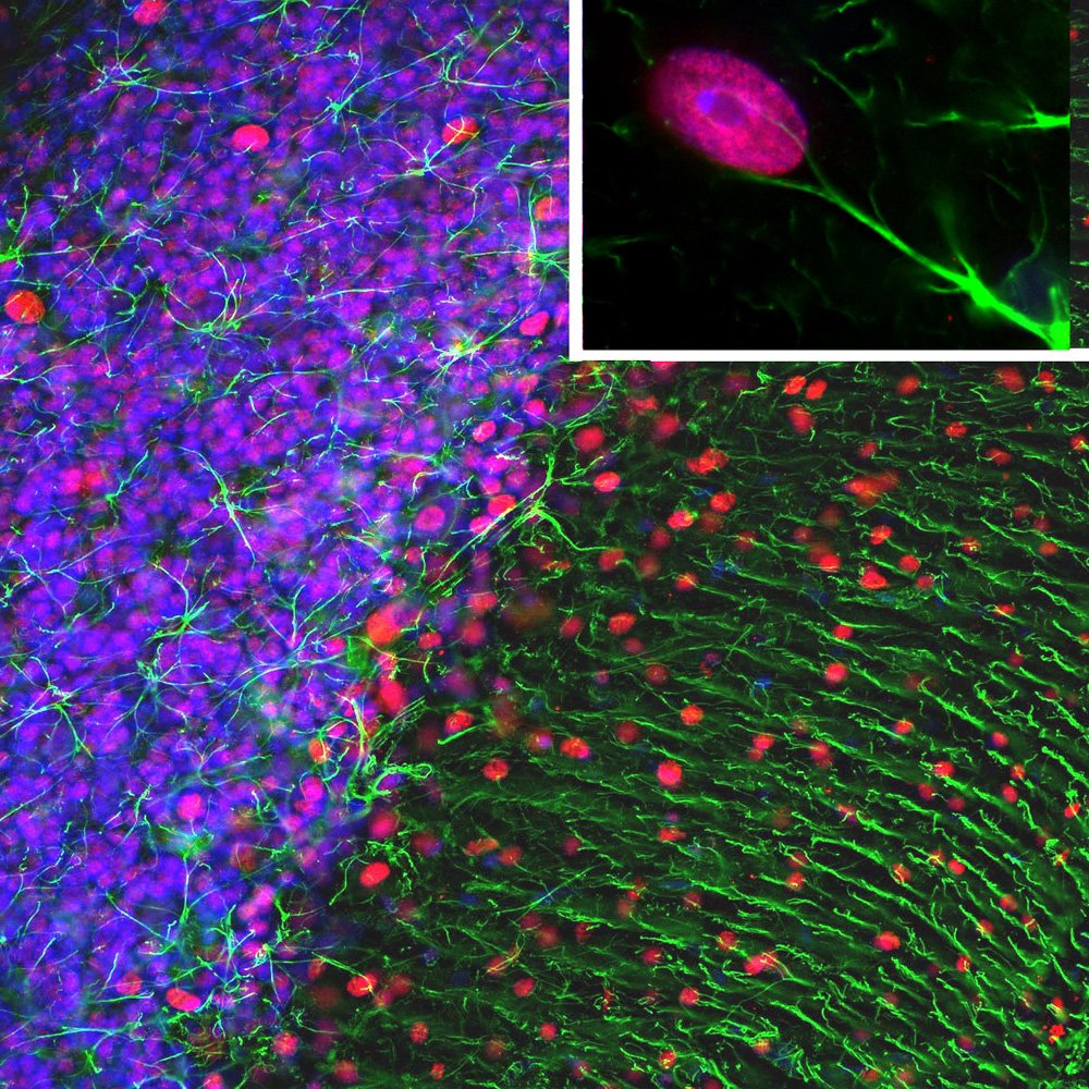 ICC/IF-image-rabbit-anti-GFAP-polyclonal-antibody-2539