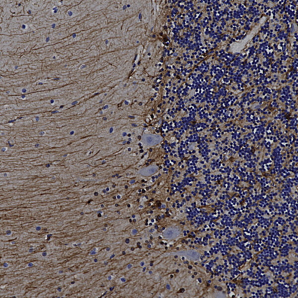 IHC image rabbit anti GFAP polyclonal antibody 2539