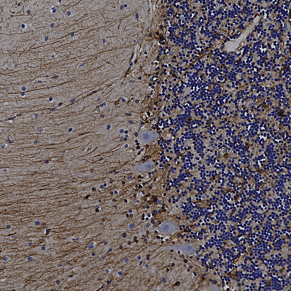 IHC-image-rabbit-anti-GFAP-polyclonal-antibody-2539