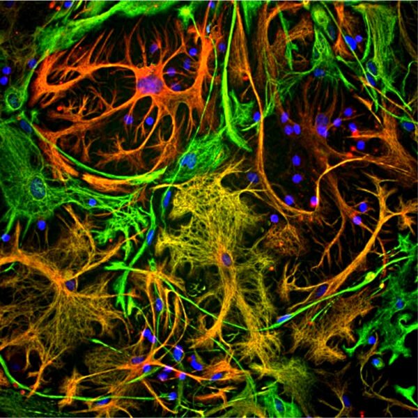 ICC/IF image rabbit anti GFAP polyclonal antibody 2539