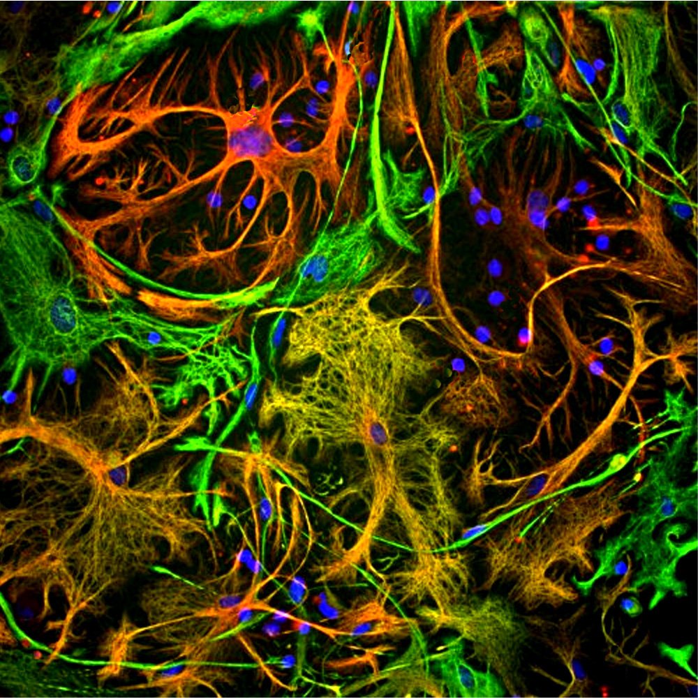 ICC/IF-image-rabbit-anti-GFAP-polyclonal-antibody-2539
