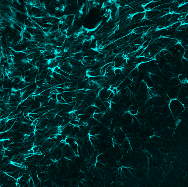rabbit anti-GFAP polyclonal antibody 2539 - Image 5