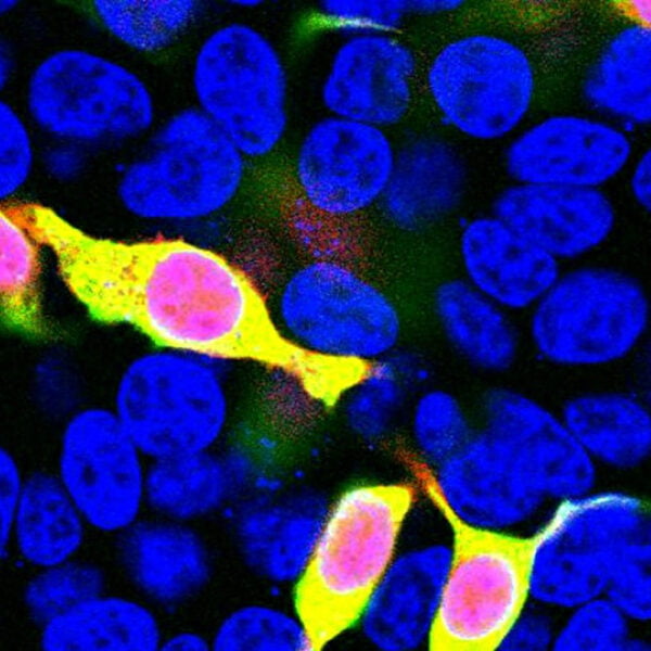 ICC/IF image rabbit anti mCherry polyclonal antibody 2999