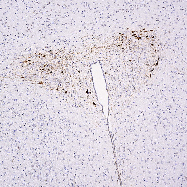 IHC image rabbit anti mCherry polyclonal antibody 2999