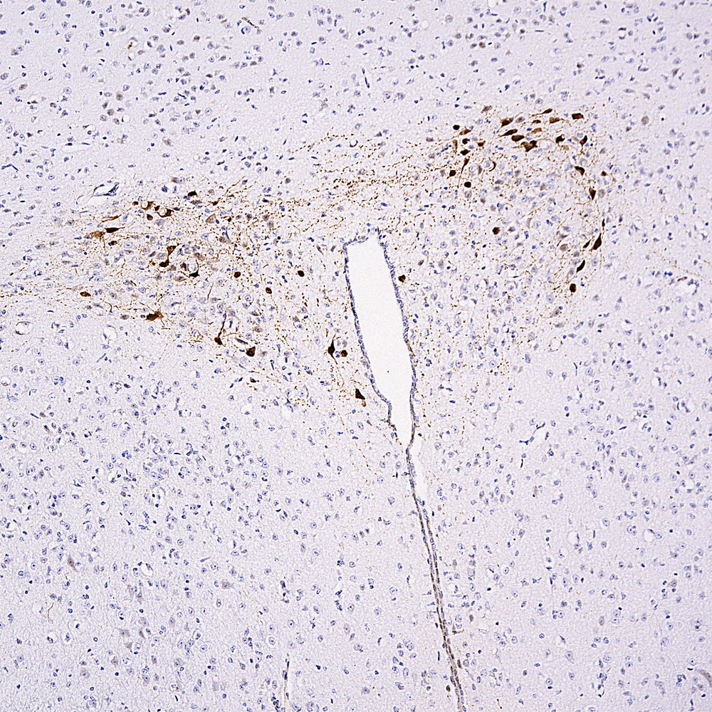 IHC-image-rabbit-anti-mCherry-polyclonal-antibody-2999