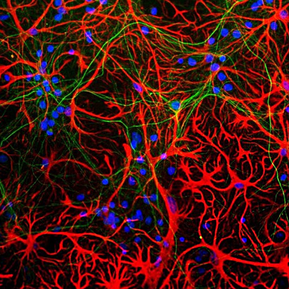 ICC/IF-image-mouse-anti-GFAP-monoclonal-antibody-5C10-3743