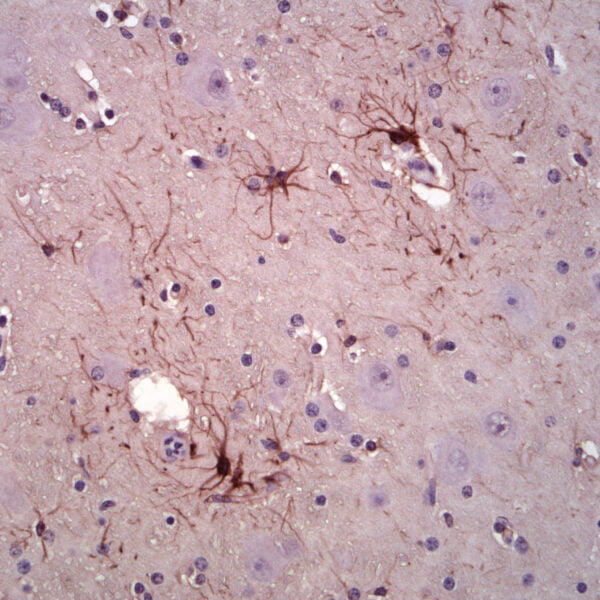 IHC image mouse anti GFAP monoclonal antibody 5C10 3743