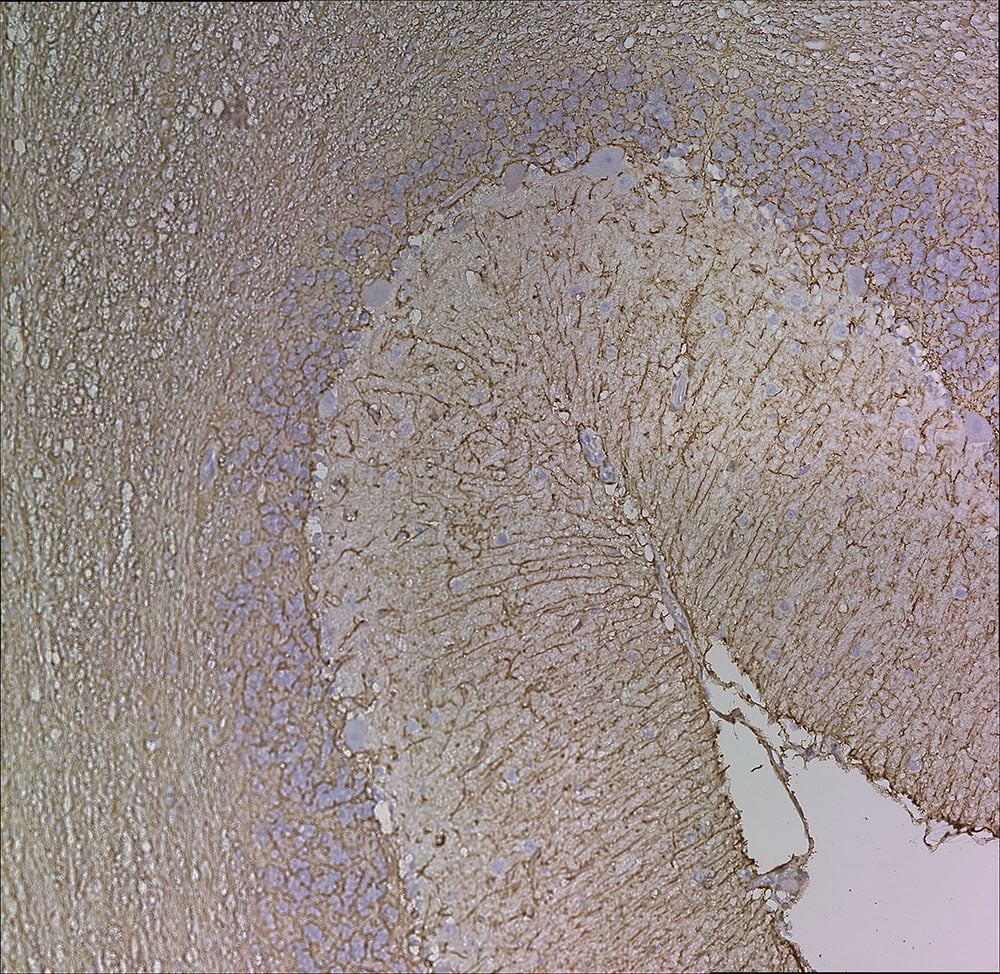 IHC-image-mouse-anti-GFAP-monoclonal-antibody-5C10-3743
