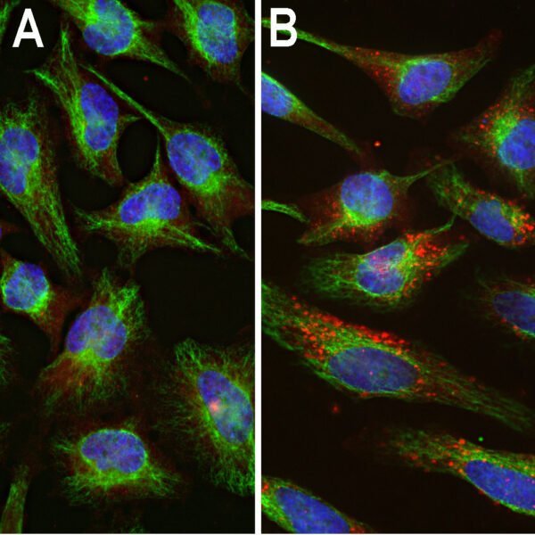 ICC/IF image rabbit anti Ubiquitin polyclonal antibody 5775