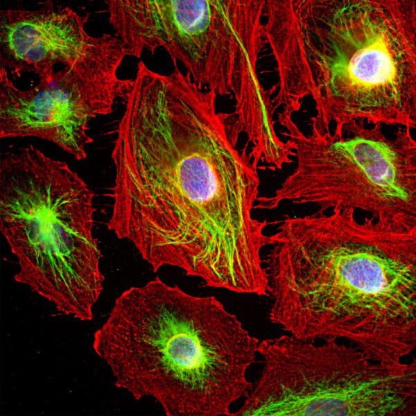 ICC/IF image rabbit anti Vimentin polyclonal antibody 5866