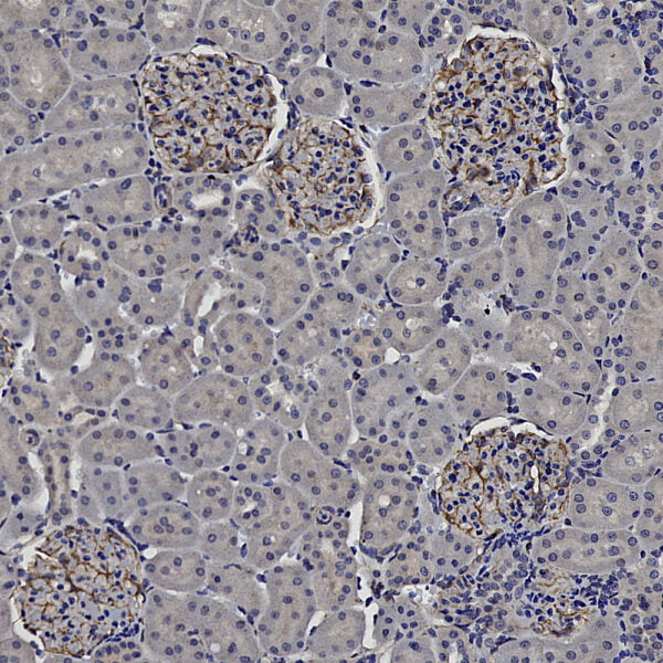 IHC image rabbit anti Vimentin polyclonal antibody 5866