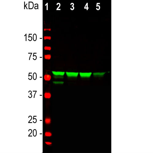WB-image-rabbit-anti-Vimentin-polyclonal-antibody-5866