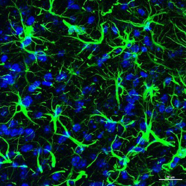 ICC/IF image chicken anti GFAP polyclonal antibody 6048