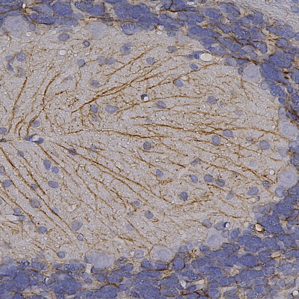 IHC image chicken anti GFAP polyclonal antibody 6048