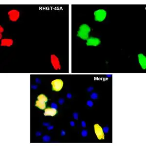 ICC/IF image rabbit anti HA tag polyclonal antibody 6395