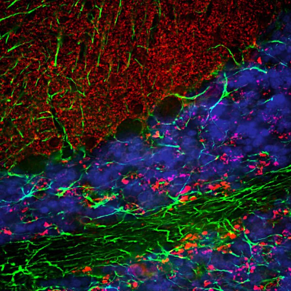ICC/IF image chicken anti Alpha synuclein polyclonal antibody 6438