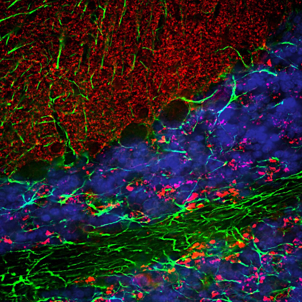 ICC/IF-image-chicken-anti-Alpha-synuclein-polyclonal-antibody-6438