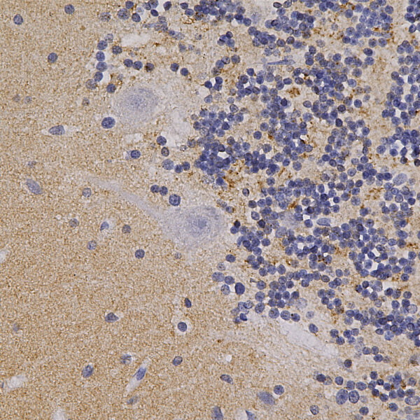 IHC image chicken anti Alpha synuclein polyclonal antibody 6438