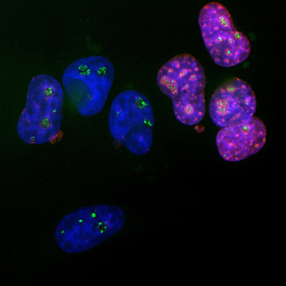 ICC/IF-image-mouse-anti-Ki67-monoclonal-antibody-5F86-7961
