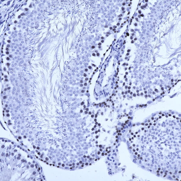 IHC image mouse anti Ki67 monoclonal antibody 5F86 7961