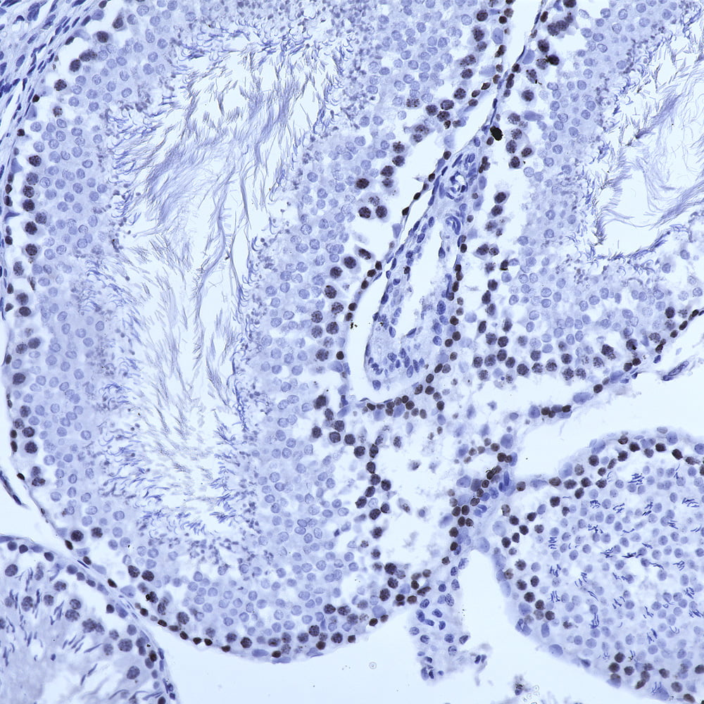IHC-image-mouse-anti-Ki67-monoclonal-antibody-5F86-7961
