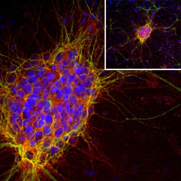 ICC/IF image mouse anti Doublecortin monoclonal antibody 3E1 8001