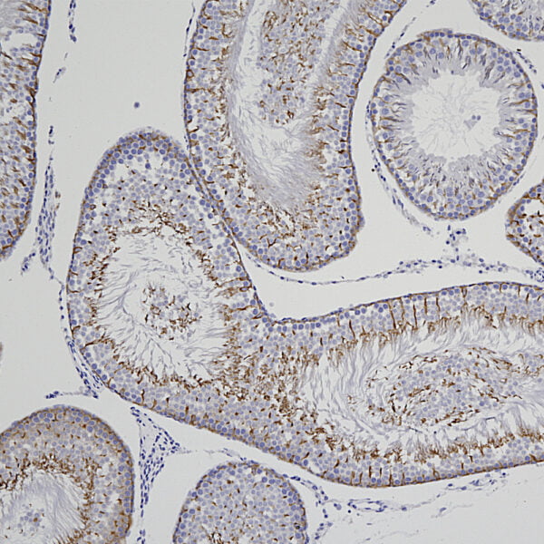 IHC image mouse anti Doublecortin monoclonal antibody 3E1 8001