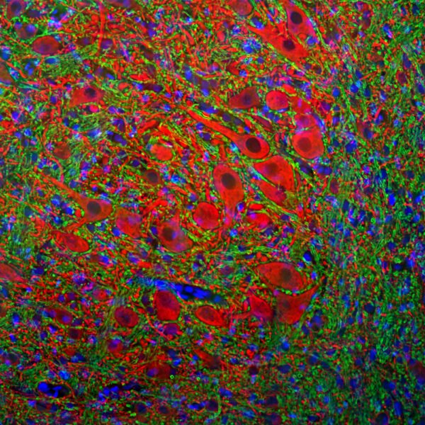 ICC/IF image goat anti MAP2 polyclonal antibody 8718