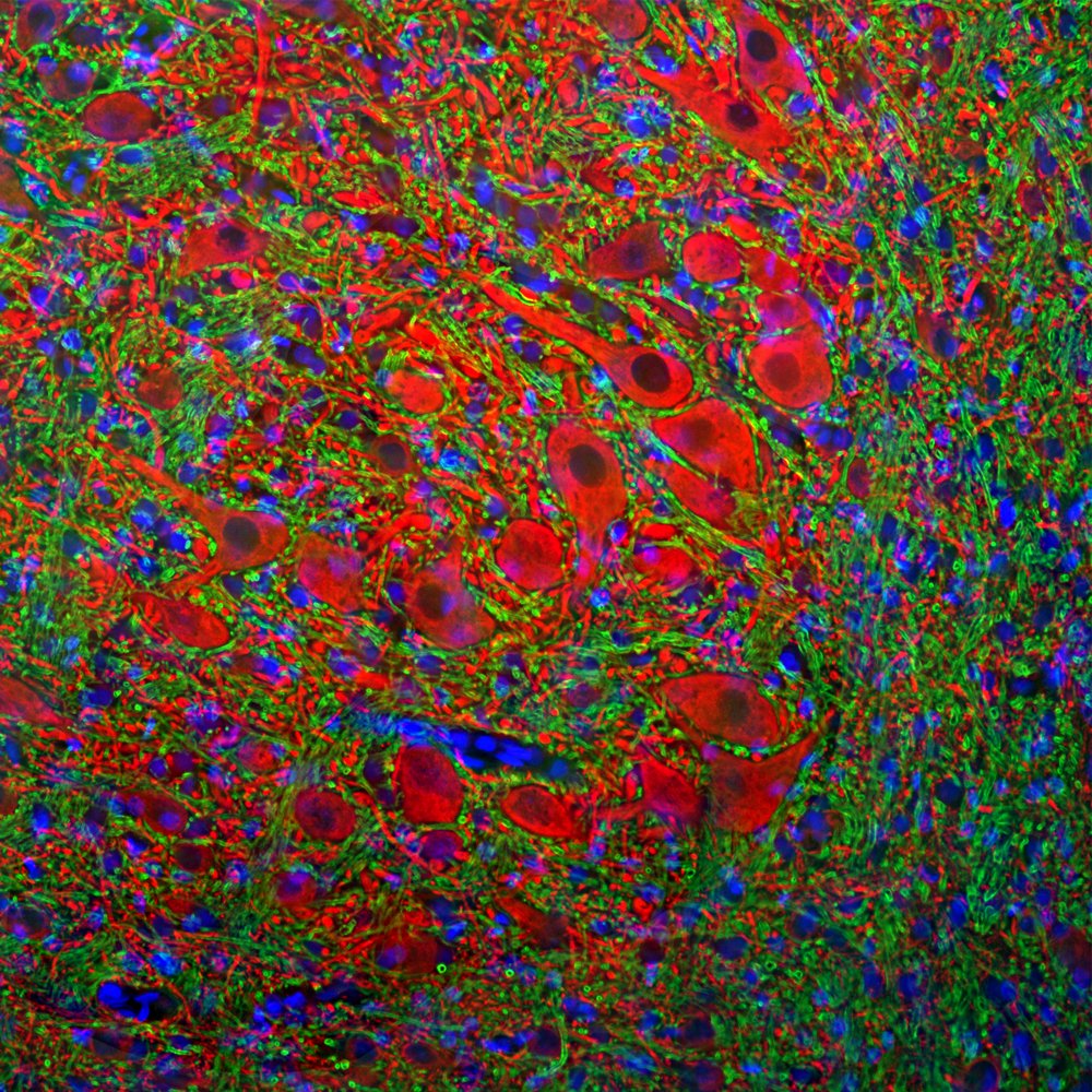 ICC/IF-image-goat-anti-MAP2-polyclonal-antibody-8718