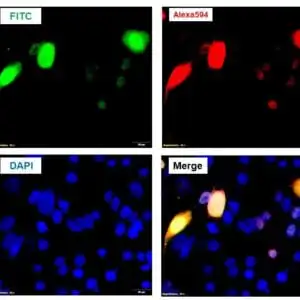 ICC/IF image chicken anti HA tag polyclonal antibody 9232