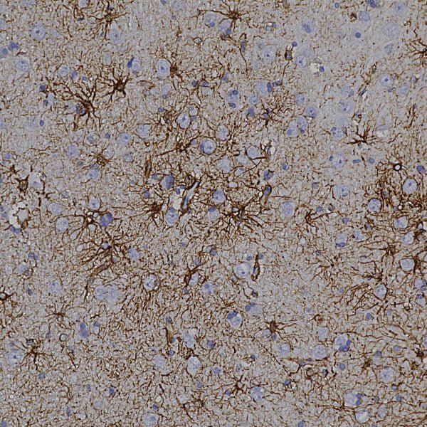 IHC image mouse anti GFAP monoclonal antibody 3E10 9418