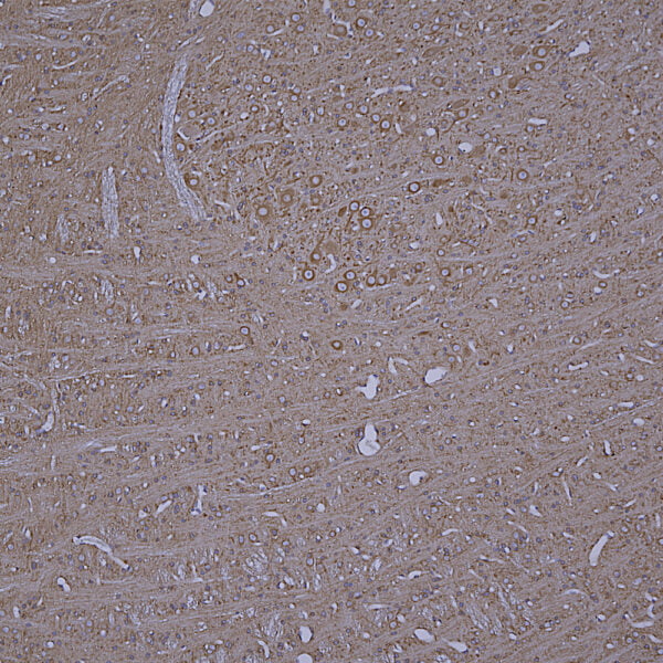 IHC image mouse anti beta Tubulin monoclonal antibody 4E4 1222