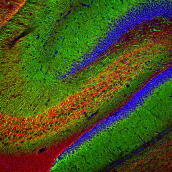 ICC/IF image mouse anti MAP2 monoclonal antibody 5H11 1367