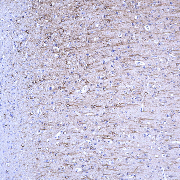 IHC image mouse anti MAP2 monoclonal antibody 5H11 1367