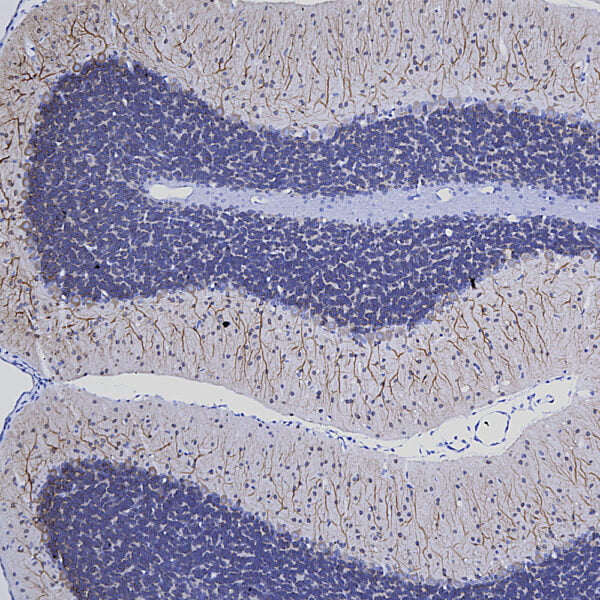 IHC image mouse anti MAP2 monoclonal antibody 5H11 1367