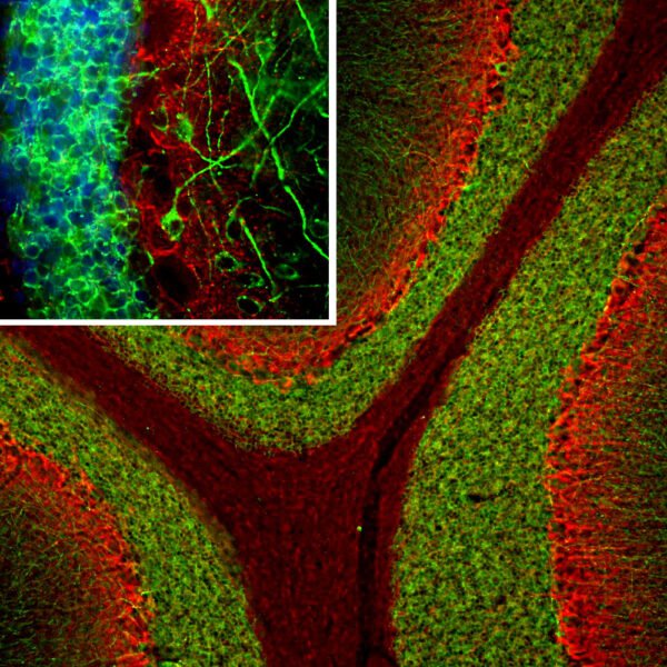 ICC/IF image mouse anti MAP2 monoclonal antibody 5H11 1367