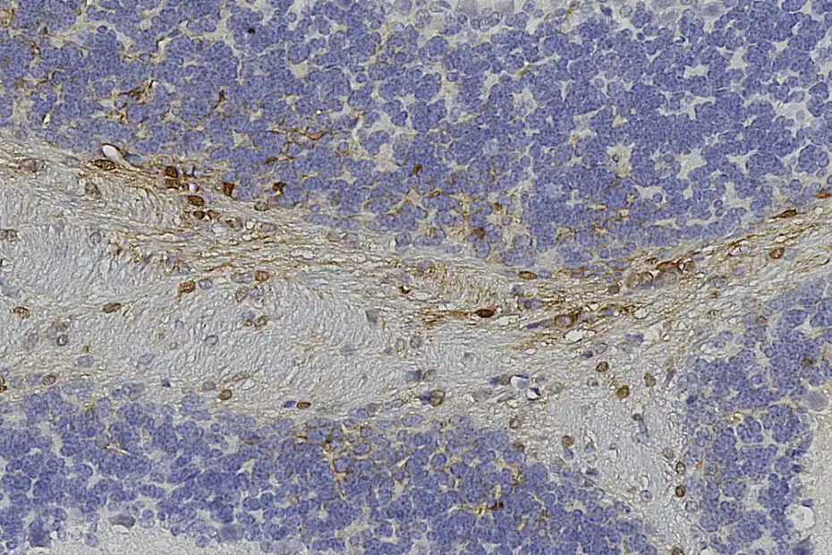IHC image goat anti GFP polyclonal antibody 1379