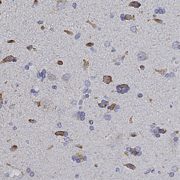 IHC image chicken anti Hsp60 polyclonal antibody 1416