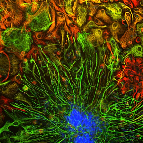 ICC/IF image mouse anti Vimentin monoclonal antibody 2D1 1666