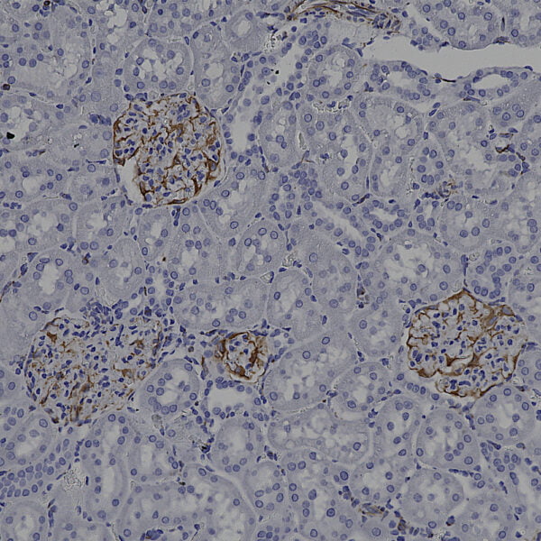 IHC image mouse anti Vimentin monoclonal antibody 2D1 1666